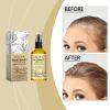 Eelhoe Rosemary Ginger Hair Spray, Dry Hair, Smooth Hair And Hair Loss