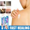 Jaysuing Warts Cream, Skin Granules Gram Wart Care Topical Cream